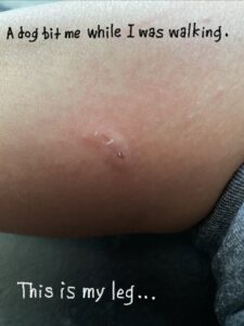 a dog bit me randomly on the street